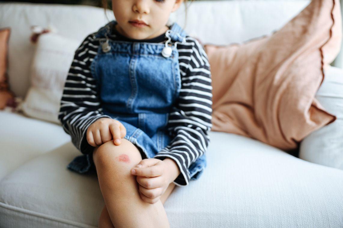 Little girl looking at a cut on her leg