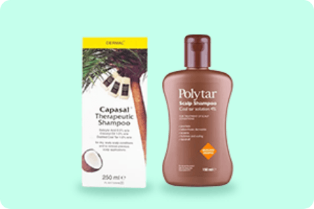 https://a.storyblok.com/f/263052/450x300/5a9a6a5e49/dandruff-psoriasis-scalp.png