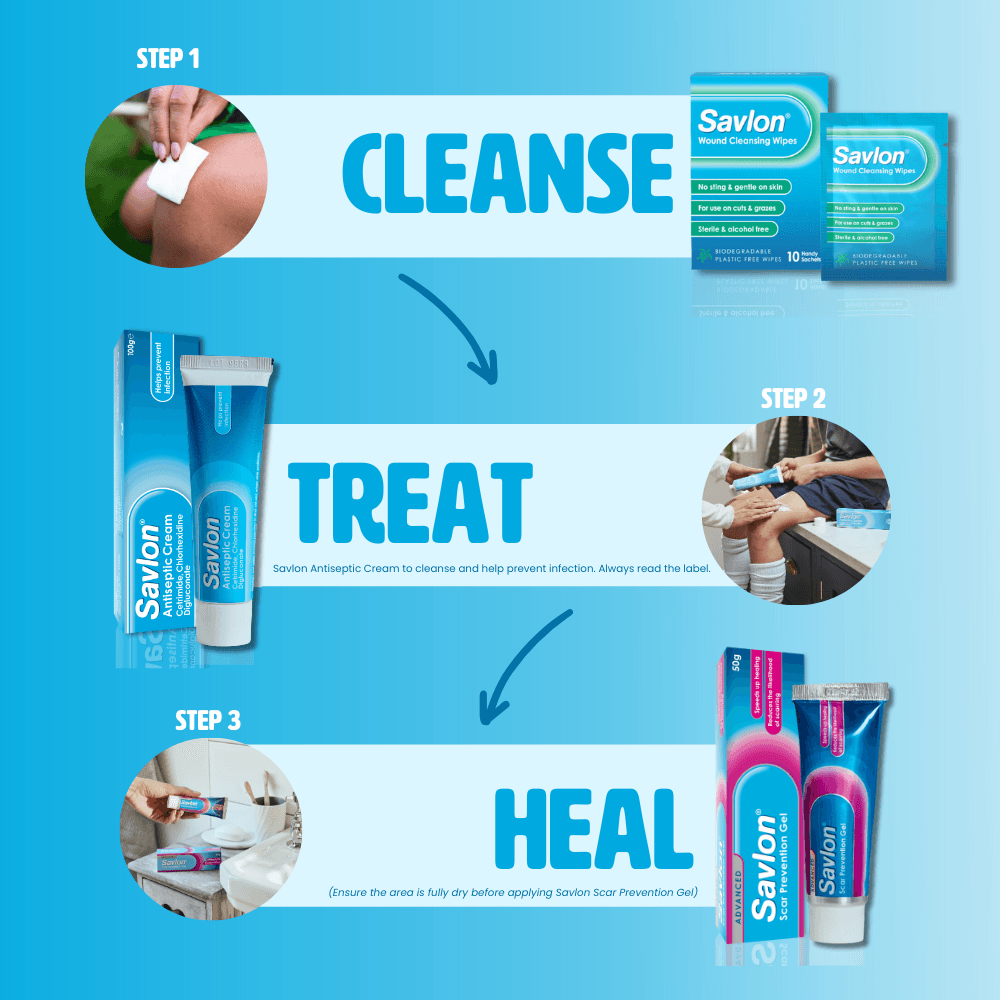 Savlon Antiseptic Cream 60g Image https://cdn11.bigcommerce.com/s-g585yu857h/images/stencil/1280w/products/11752/19287/3._SAVLON__20383.1782895827.png1