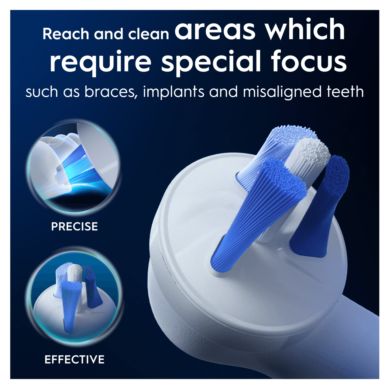 Oral-B iO Interdental Clean Brush Heads 4 Pack Image https://cdn11.bigcommerce.com/s-g585yu857h/images/stencil/1280w/products/14670/25837/8700216605076_T62__26210.1767953572.png1