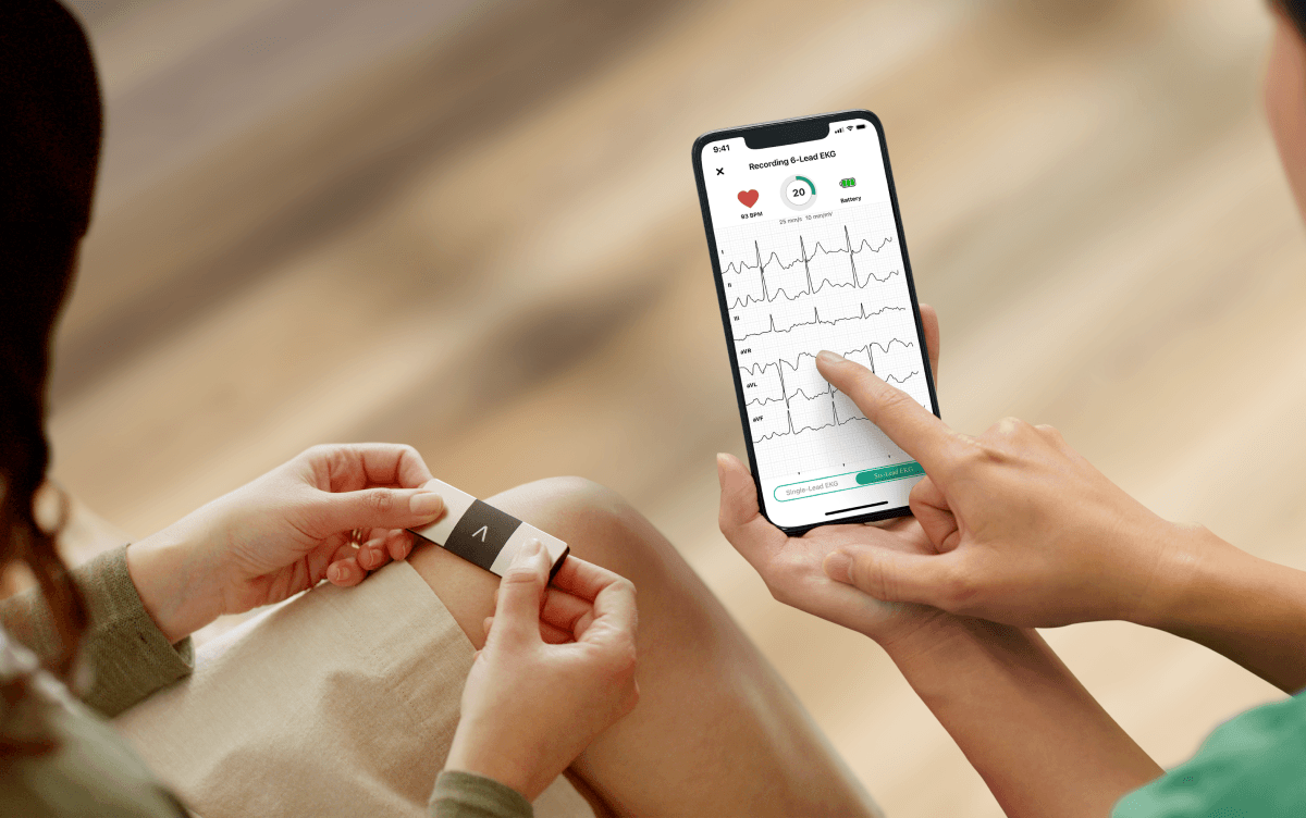 Alivecor KardiaMobile Six Lead ECG Heart Monitor Image https://cdn11.bigcommerce.com/s-g585yu857h/images/stencil/1280w/products/1683/2520/AliveCor-KardiaMobile-6L__37156__22470.1780491123.png1