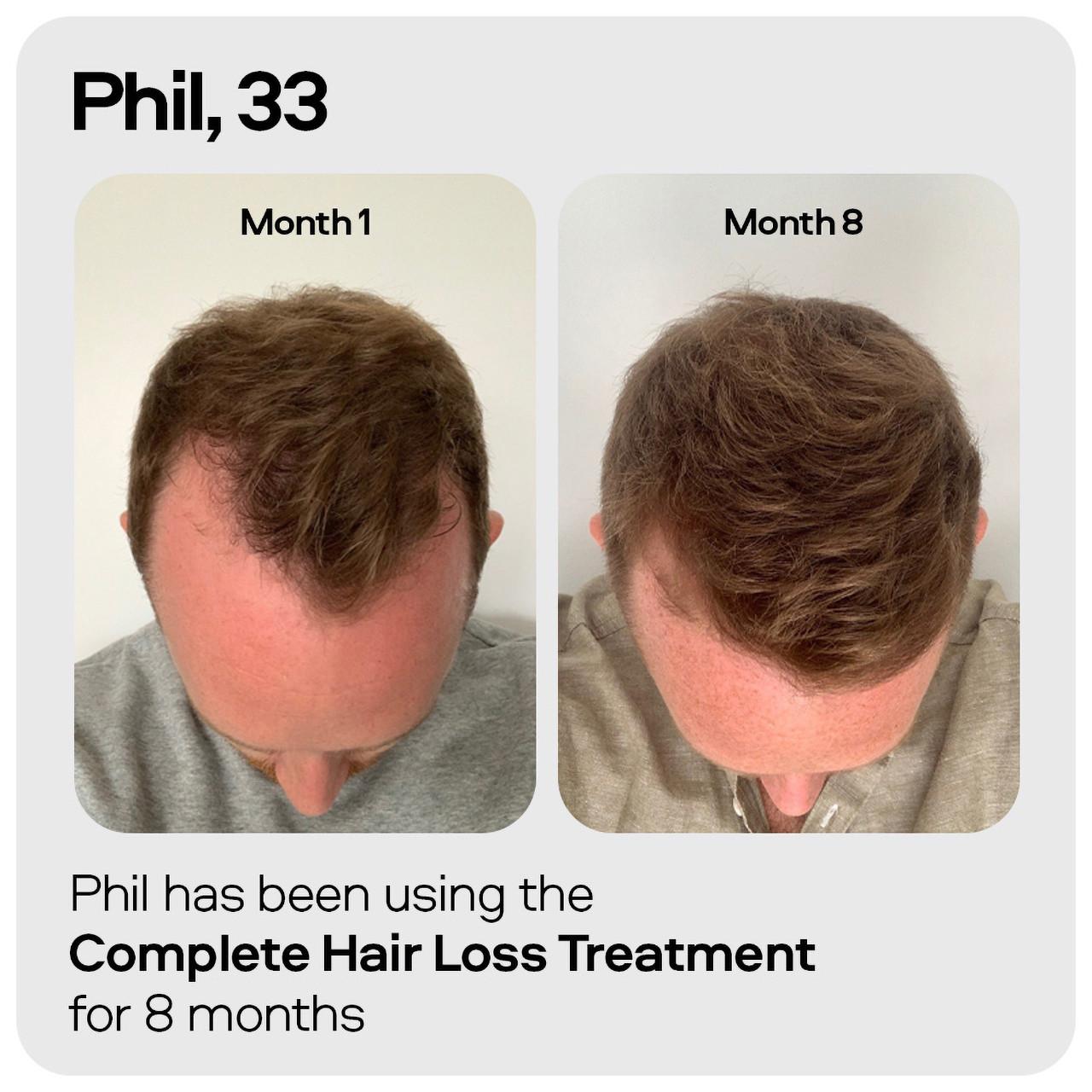 Sons DHT Blocking Hair Growth Shampoo 200ml Image https://cdn11.bigcommerce.com/s-g585yu857h/images/stencil/1280w/products/2932/10650/4234761_06__85556.1781535833.jpg1