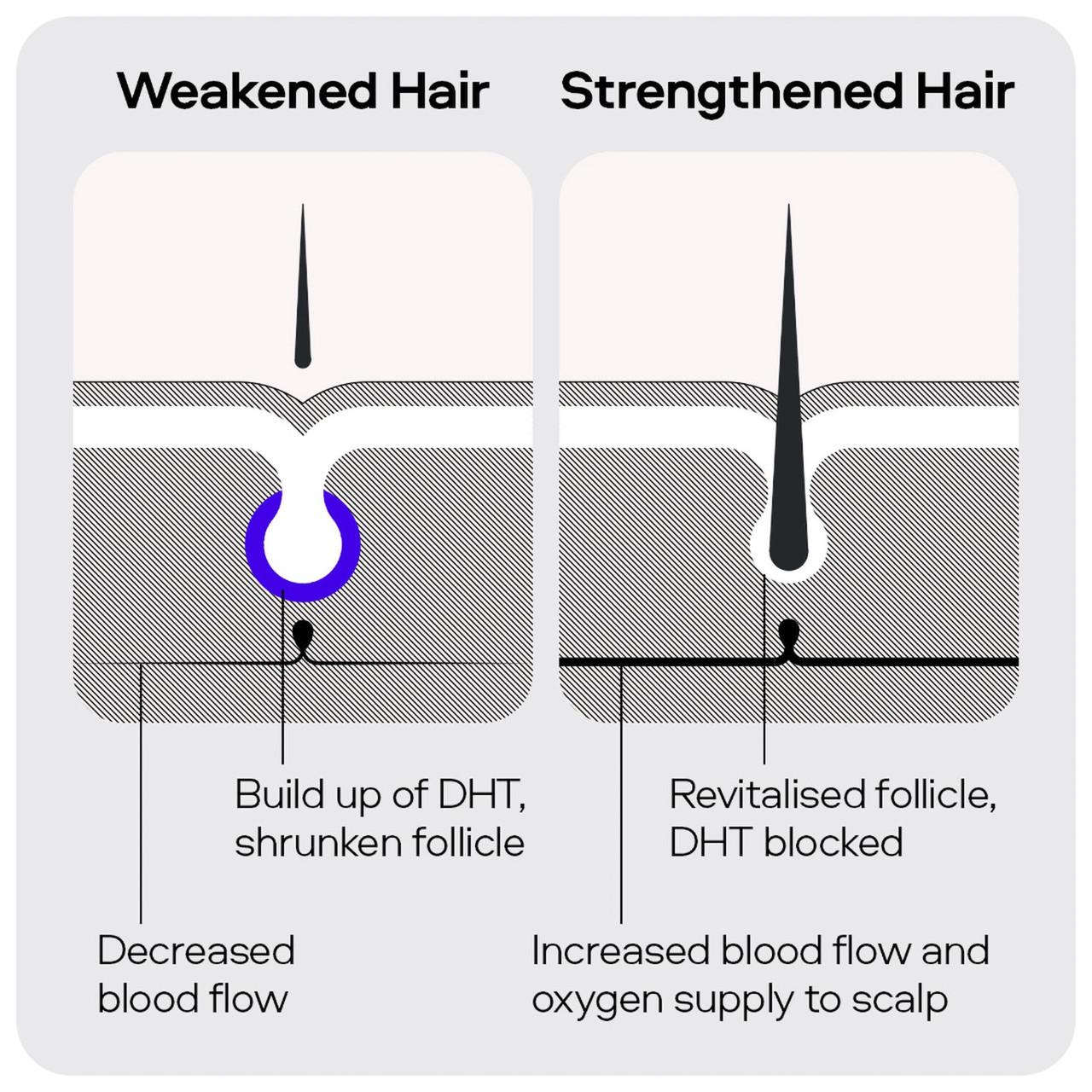 Sons Minoxidil 5% Spray 1 Month Image https://cdn11.bigcommerce.com/s-g585yu857h/images/stencil/1280w/products/2962/10632/4234779_05__14407.1740667908.jpg1