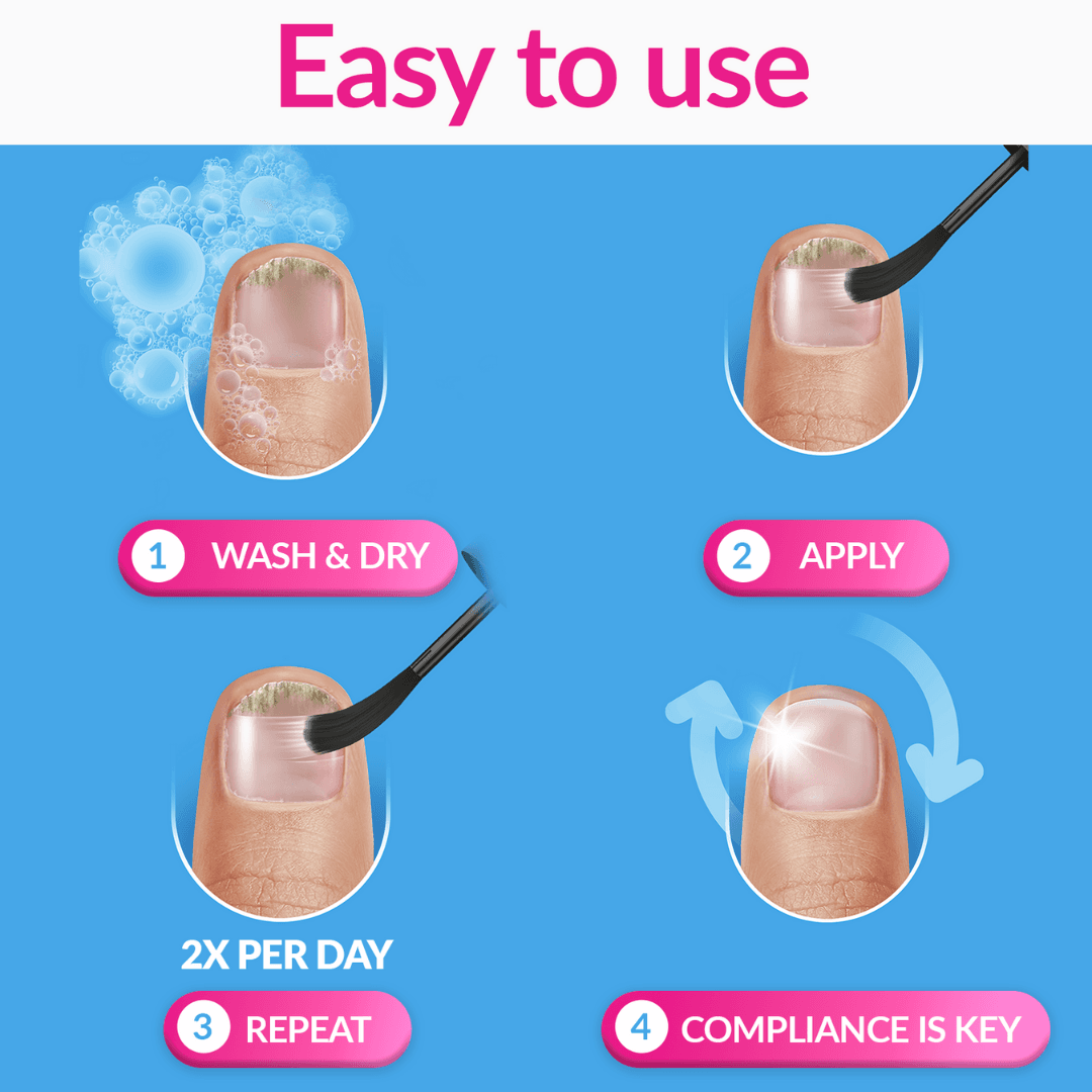 Excilor Solution Fungal Nail Treatment 3.3ml Image https://cdn11.bigcommerce.com/s-g585yu857h/images/stencil/1280w/products/3207/16664/0097509F__94712.1752844209.png1