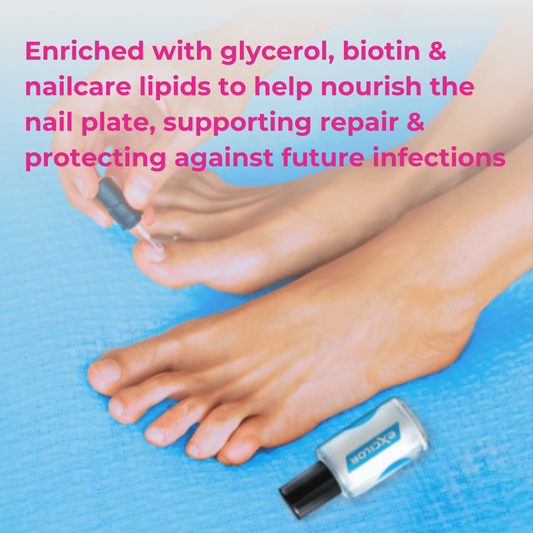 Excilor Solution Fungal Nail Treatment 3.3ml Image https://cdn11.bigcommerce.com/s-g585yu857h/images/stencil/1280w/products/3207/16666/0097509G__51934.1752844209.png1
