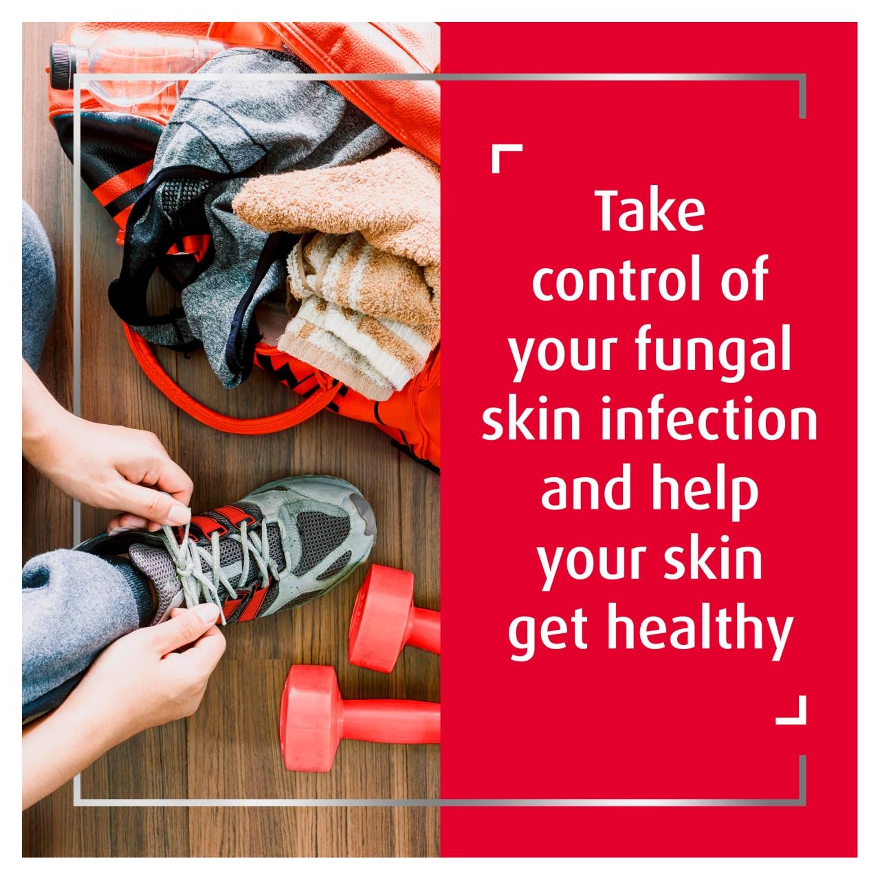 Canesten Bifonazole Once Daily Athletes Foot Cream 1% 20g Image https://cdn11.bigcommerce.com/s-g585yu857h/images/stencil/1280w/products/3253/19960/5010605055119_T63___21423.1784630776.jpg1