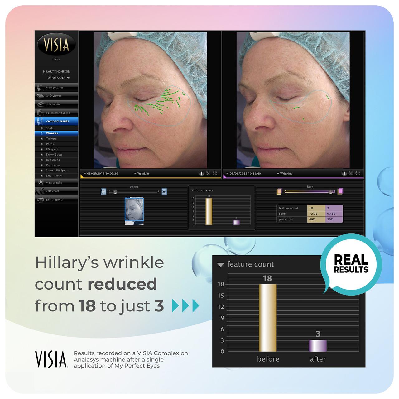 My Perfect Eyes 10ml Image https://cdn11.bigcommerce.com/s-g585yu857h/images/stencil/1280w/products/3411/16393/708191951087_708302488105_6__70672.1752156843.jpg1