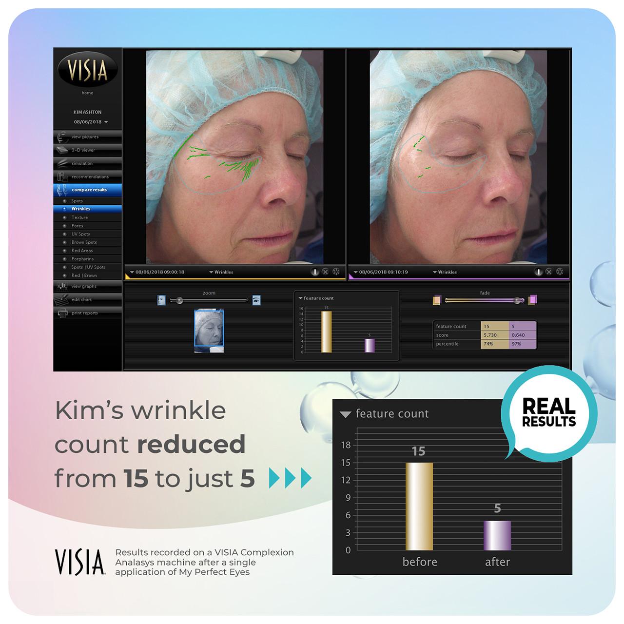 My Perfect Eyes 10ml Image https://cdn11.bigcommerce.com/s-g585yu857h/images/stencil/1280w/products/3411/16394/708191951087_708302488105_8__32710.1752156843.jpg1