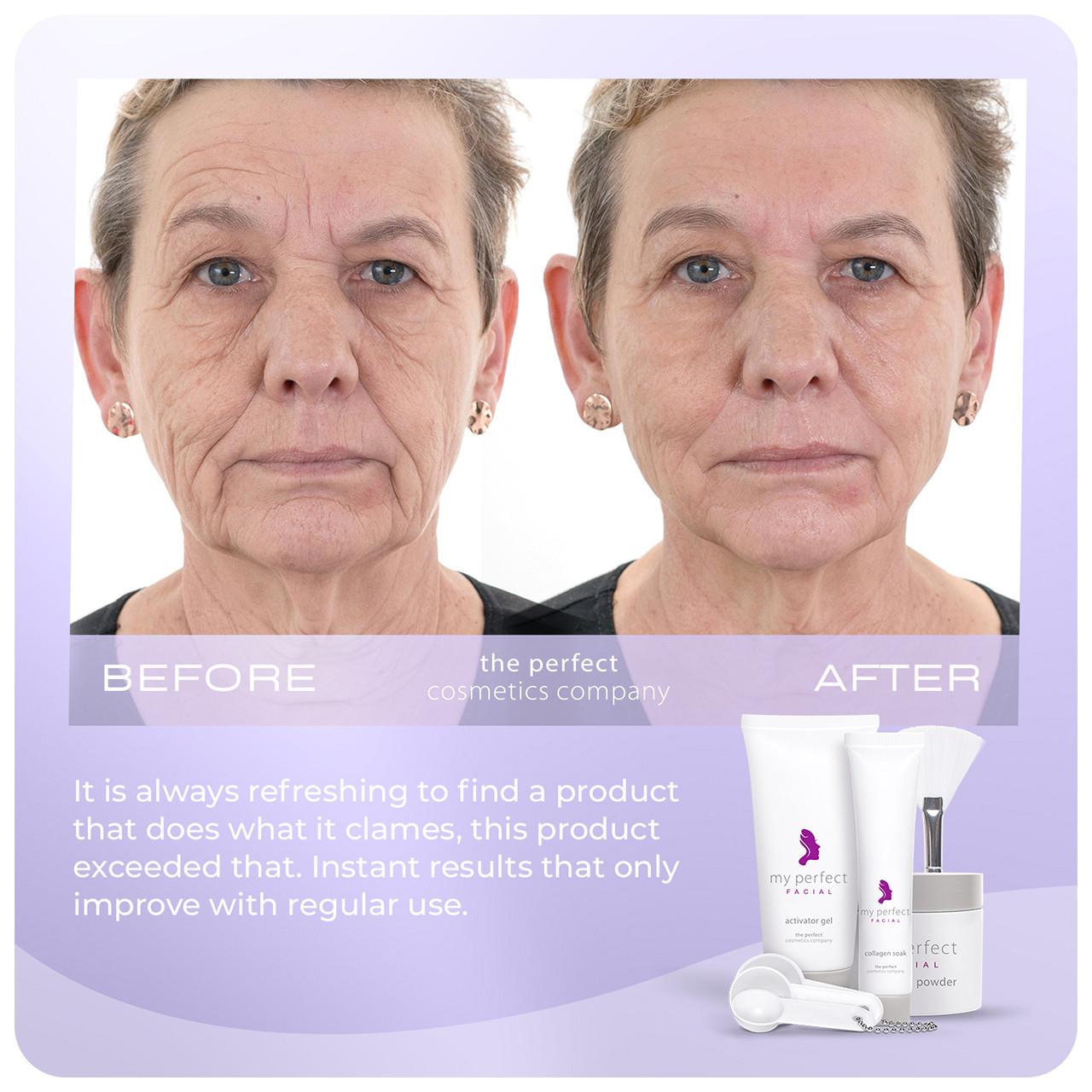 My Perfect Facial 5 Treatments Image https://cdn11.bigcommerce.com/s-g585yu857h/images/stencil/1280w/products/3581/16399/708302488143_708191951094_4__51385.1752156894.jpg1