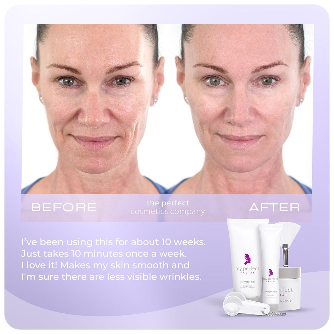 My Perfect Facial 5 Treatments Image https://cdn11.bigcommerce.com/s-g585yu857h/images/stencil/1280w/products/3581/16401/708302488143_708191951094_3__81105.1781536140.jpg1