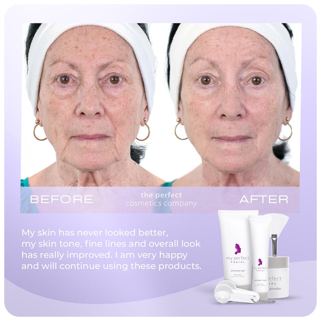 My Perfect Facial 5 Treatments Image https://cdn11.bigcommerce.com/s-g585yu857h/images/stencil/1280w/products/3581/16402/708302488143_708191951094_5__77652.1752156894.jpg1
