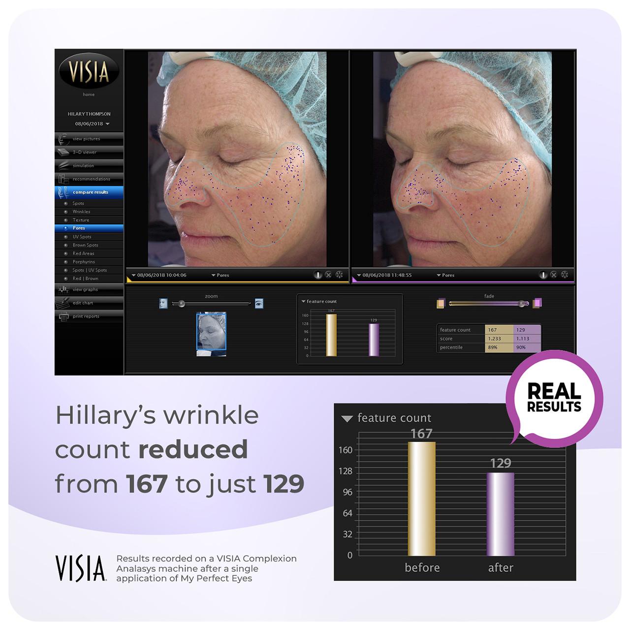 My Perfect Facial 5 Treatments Image https://cdn11.bigcommerce.com/s-g585yu857h/images/stencil/1280w/products/3581/16403/708302488143_708191951094_8__84903.1752156894.jpg1