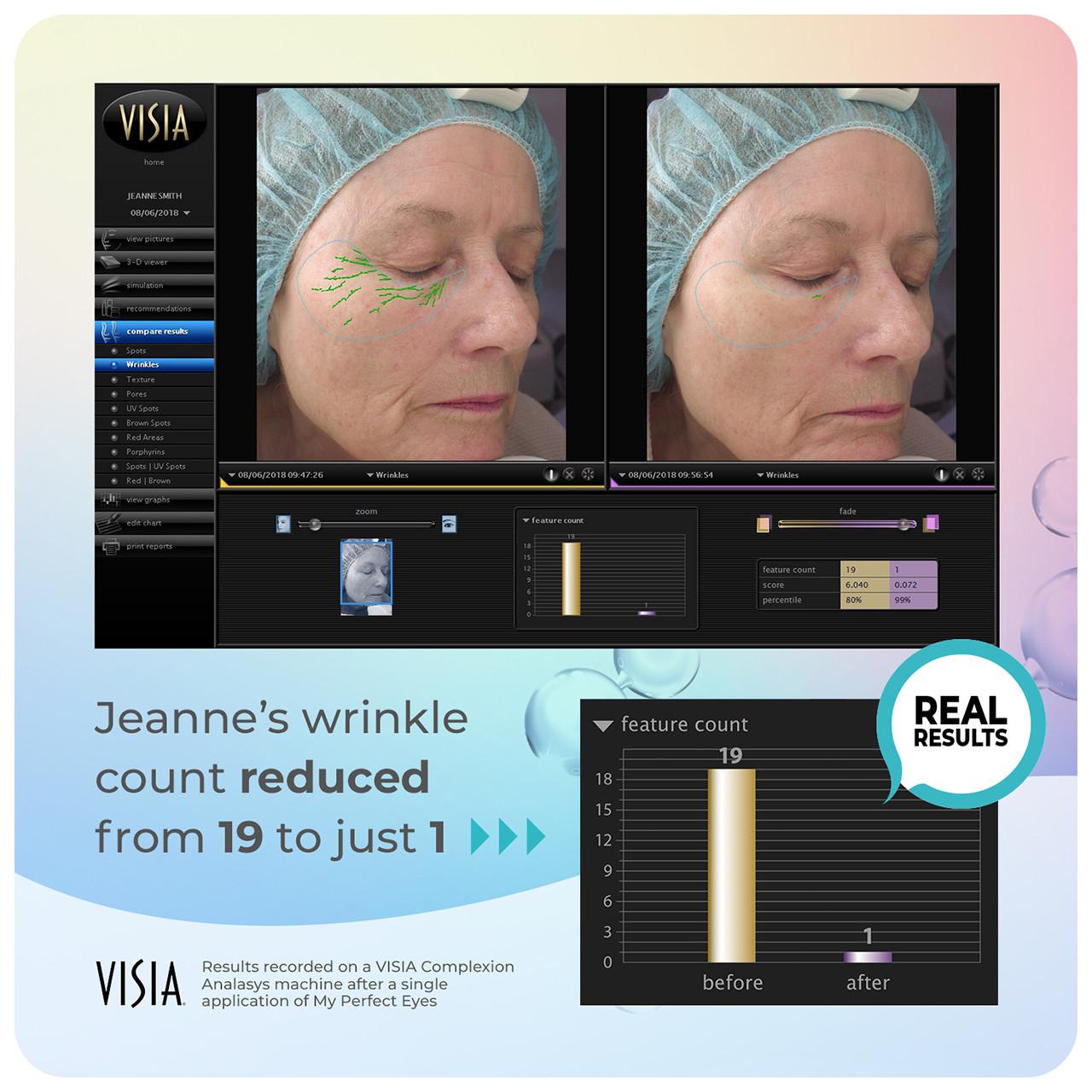 My Perfect Eyes 20ml Image https://cdn11.bigcommerce.com/s-g585yu857h/images/stencil/1280w/products/3797/16356/708191951087_708302488105_7__08575.1752156139.jpg1