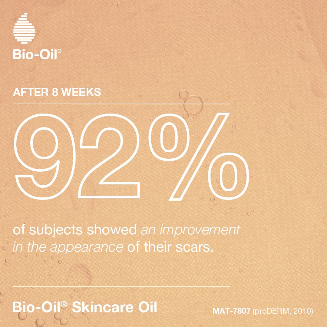 Bio-Oil Specialist Skincare Oil - 200ml Image https://cdn11.bigcommerce.com/s-g585yu857h/images/stencil/1280w/products/3969/27075/06__11191.1781536316.png1