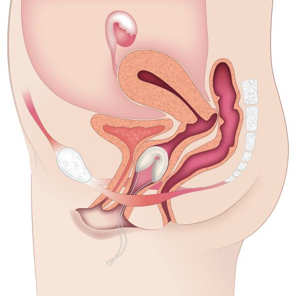 Contrelle Activgard Bladder Support Sizing Kit 1 Kit Image https://cdn11.bigcommerce.com/s-g585yu857h/images/stencil/1280w/products/4947/9412/Contrelle-Activgard-Bladder-Support-Sizing-Kit__90124__10125.1740668082.jpg1