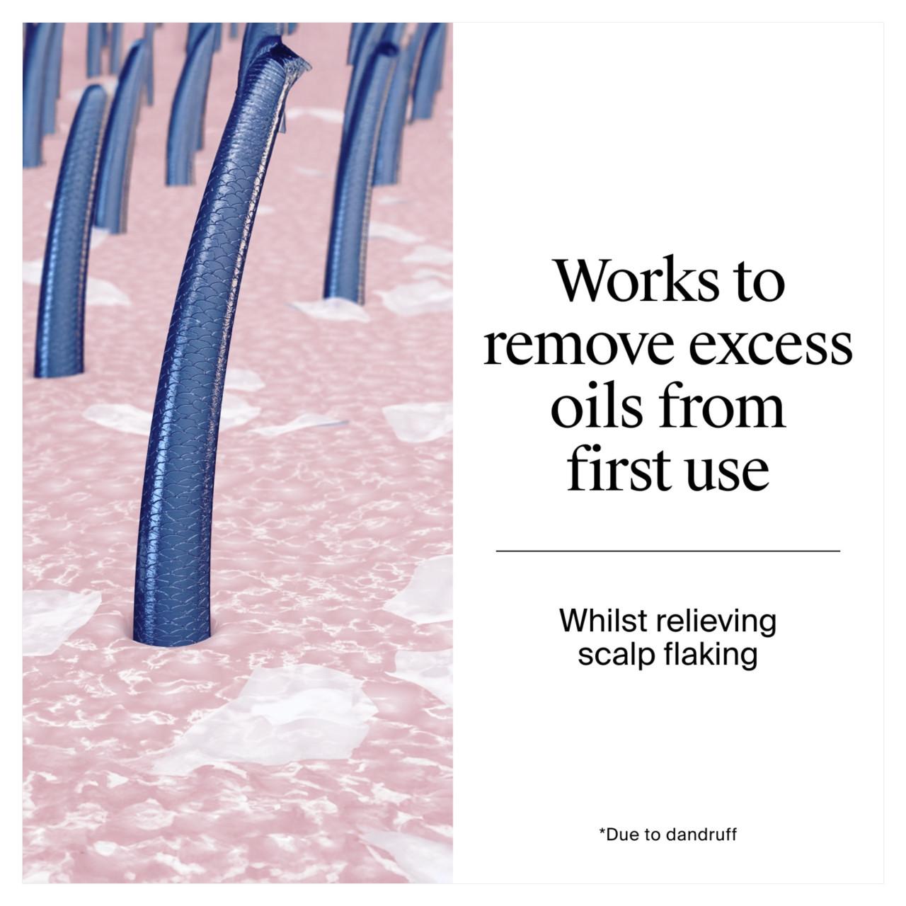 Neutrogena T/Gel Anti-Dandruff Oily Scalp Shampoo Image https://cdn11.bigcommerce.com/s-g585yu857h/images/stencil/1280w/products/7942/13775/03574661450711_T63__31327.1747059987.jpg1